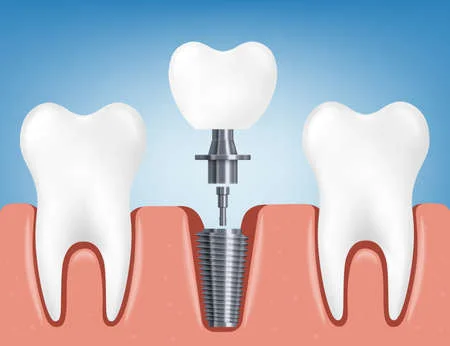cirugia oral