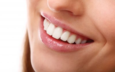 ¿Estás buscando una solución para mejorar la apariencia de tus dientes?