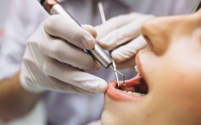 La importancia de las revisiones dentales